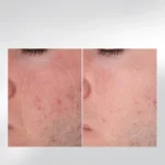 Dermalogica Light Up the Room — набір "Анти-ейдж ритуал вдома"
